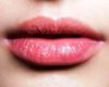 Solusi Cara Mengatasi Bibir Kering