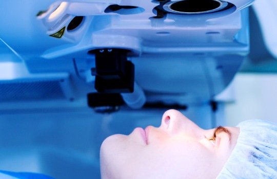 Definisi LASIK Mata, Prosedur, Keunggulan, Persiapan dan Pemulihan