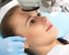 Keuntungan LASIK Bagi Anda yang Ingin Penglihatan Lebih Baik