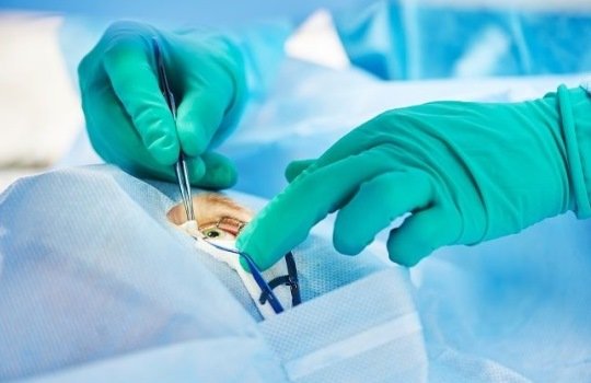 Memahami LASIK dan Faktor yang Mempengaruhi Biayanya